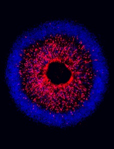 ResearchersModelHumanStemCellsToIdentifyDegenerationInGlaucoma